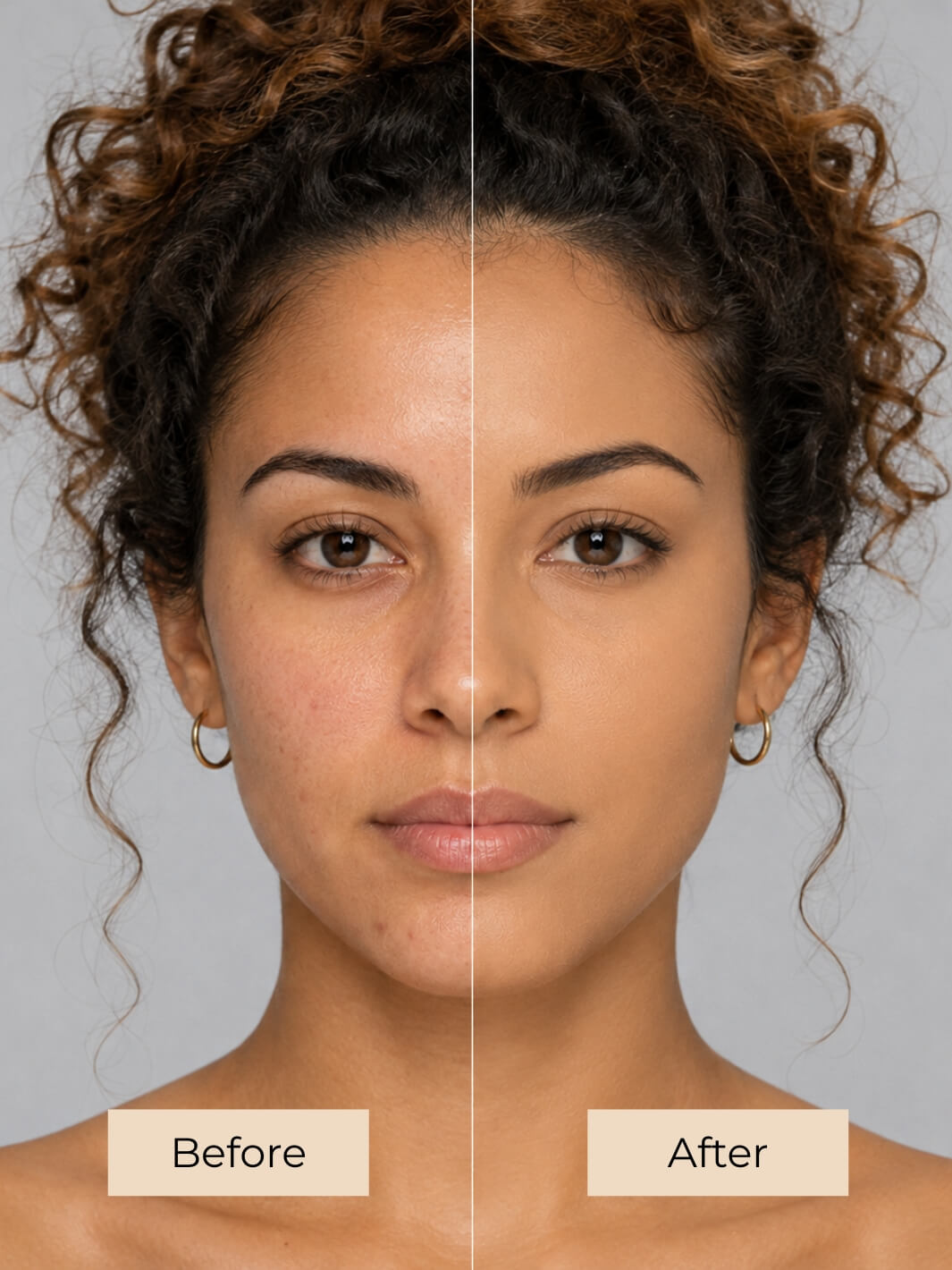 A split-screen before-and-after comparison of a woman's face, showing natural skin on the left labeled 'Before' and smoother, more even skin on the right labeled 'After' against a light gray background. #colour_french-toast